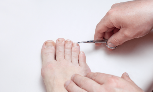 Comment bien couper ses ongles de pieds ? Les conseils de votre podologue Coline LABOUSSET